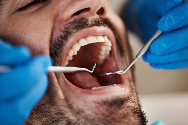 Best Emergency Tooth Extraction in Central City, IA